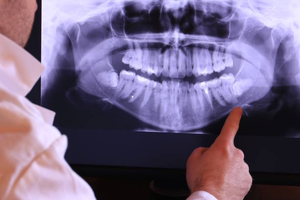 Dentist for Dental Trauma in NE